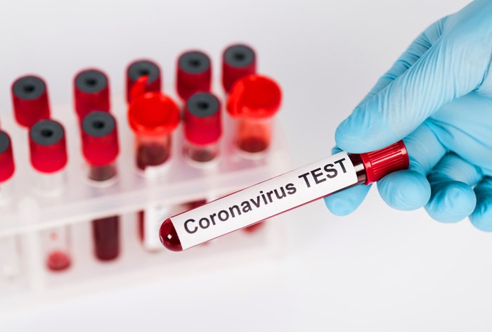 Картинка Производитель «Кагоцела» займется выпуском тестов на коронавирус